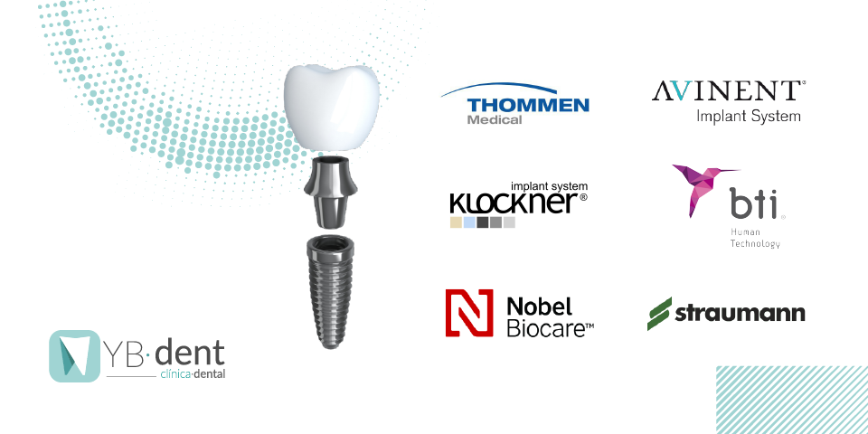 La importancia de las marcas en implantes dentales