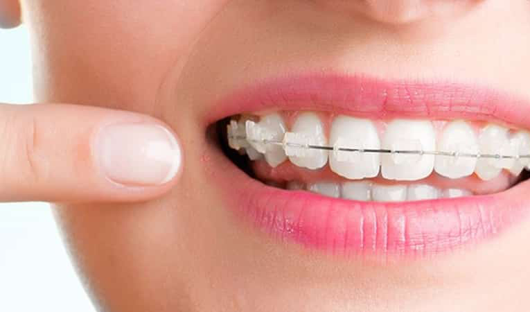 Clínica dental valencia YB-dent