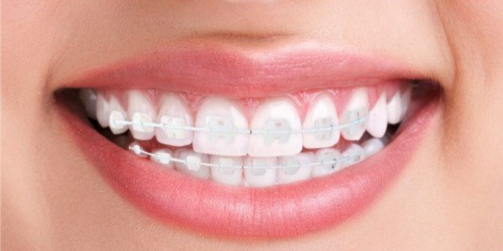 clinica dental valencia YB-dent