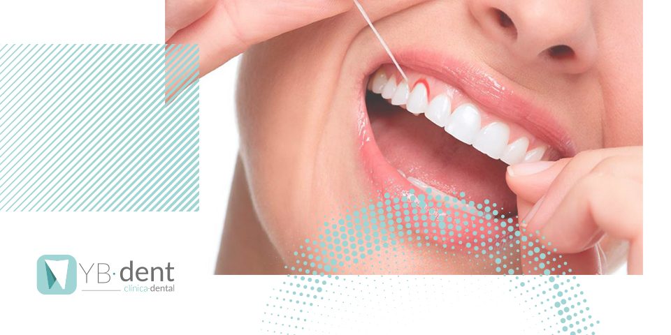 Formas de prevenir el sangrado de dientes