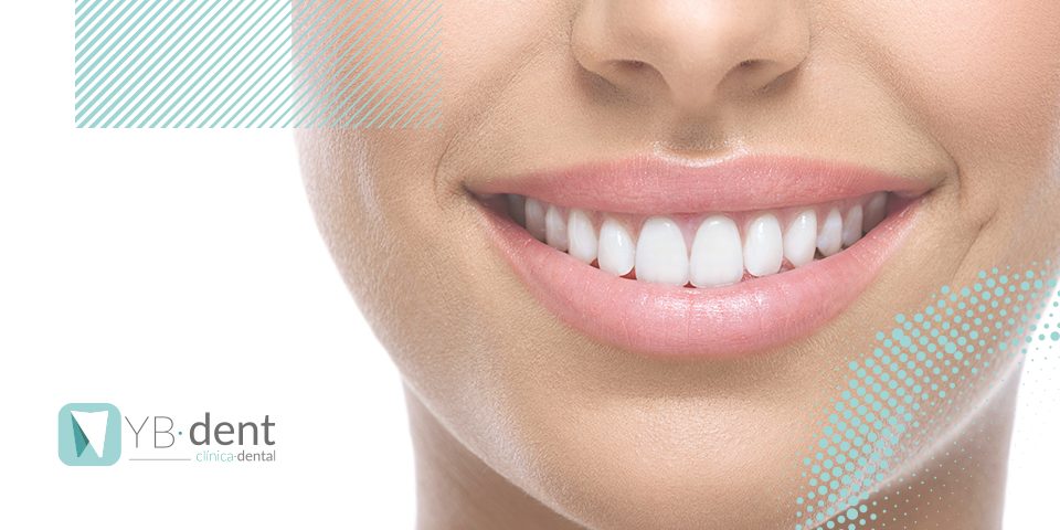 ¿Cómo conseguir unos dientes perfectos