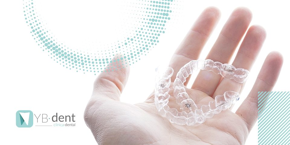 Invisalign, ventajas y cuándo está indicado