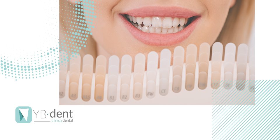 Riesgos del blanqueamiento dental