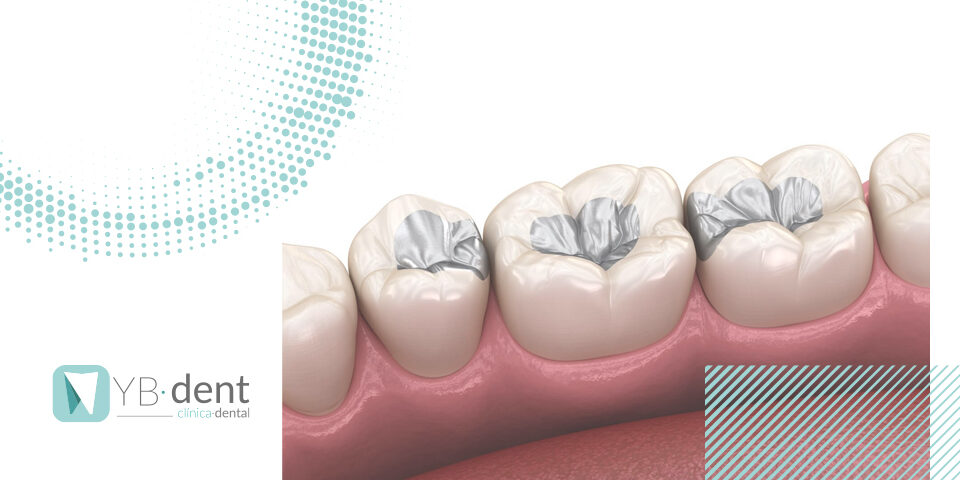 Tipos de empastes dentales