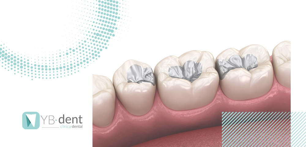 Tipos de empastes dentales